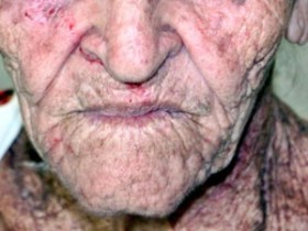 Idosa de 84 anos sofreu ferimentos no rosto
