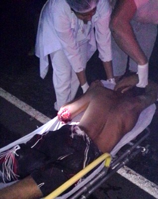 O carro pode ter passado por cima da vítima, evadindo em seguida.