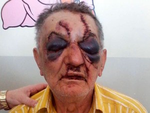idoso-agredido-2