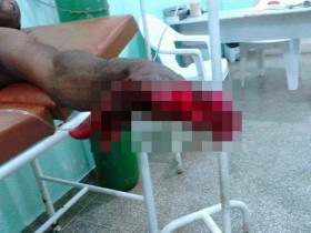 Apesar do grave acidente, vítima passa bem.