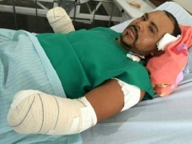 Esposa lamentou situação do marido que não vai mais poder trabalhar de pedreiro.
