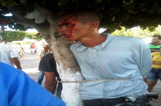 Este homem ferido possui uma arma na cintura.