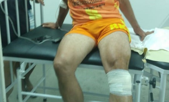 Vereador leva tiro no joelho quando retornava de partida de futebol na zona rural